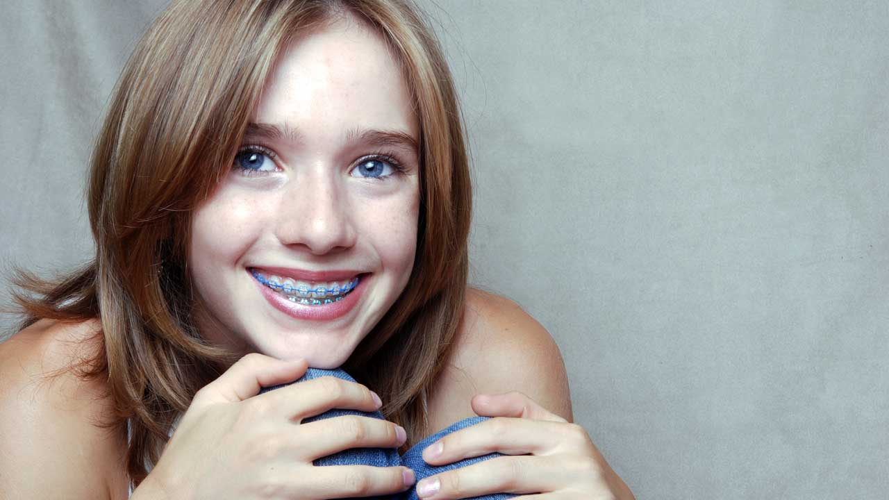 Ortho braces special